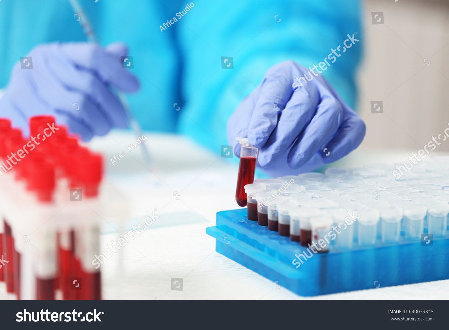 Homocysteine: Simply Explained