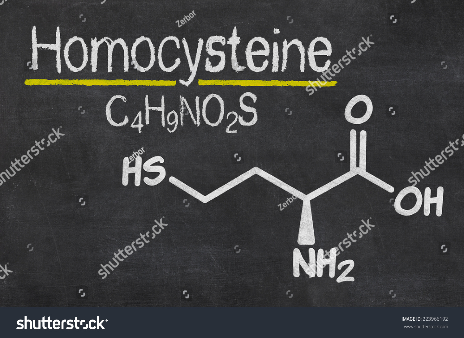 Homocysteine: A Comprehensive Overview