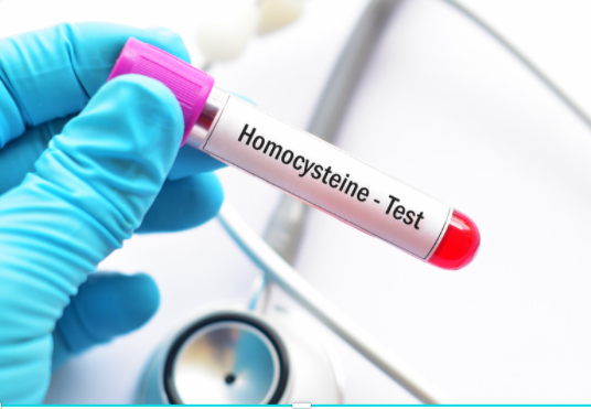 Homocysteine