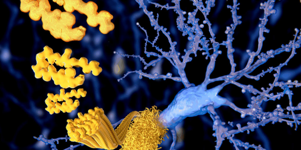 amyloid isn't alzheimers